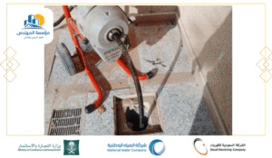 قبل وبعد شفط البيارات